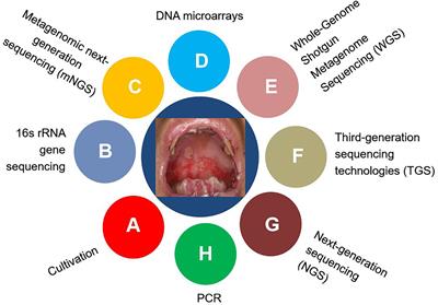 Advances in the oral microbiota and rapid detection of oral infectious diseases